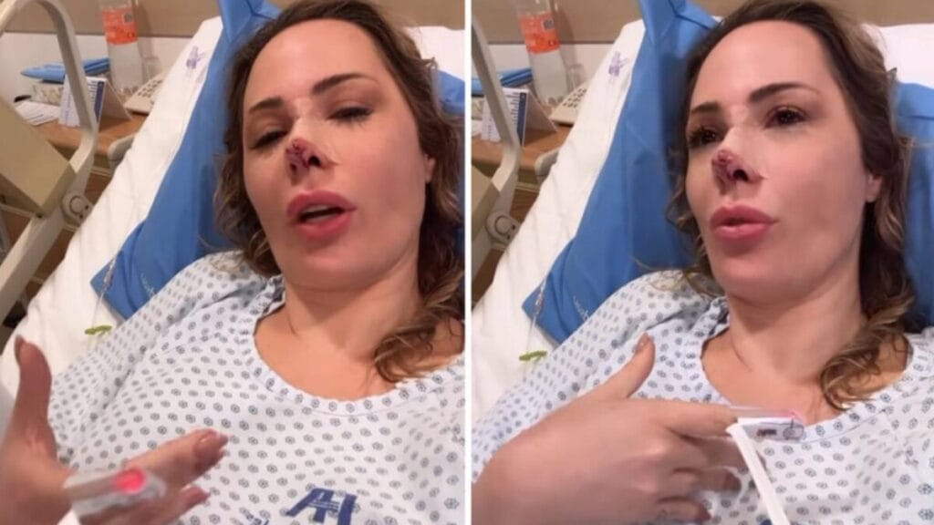 Influenciadora brasileira é atacada por cachorro no México