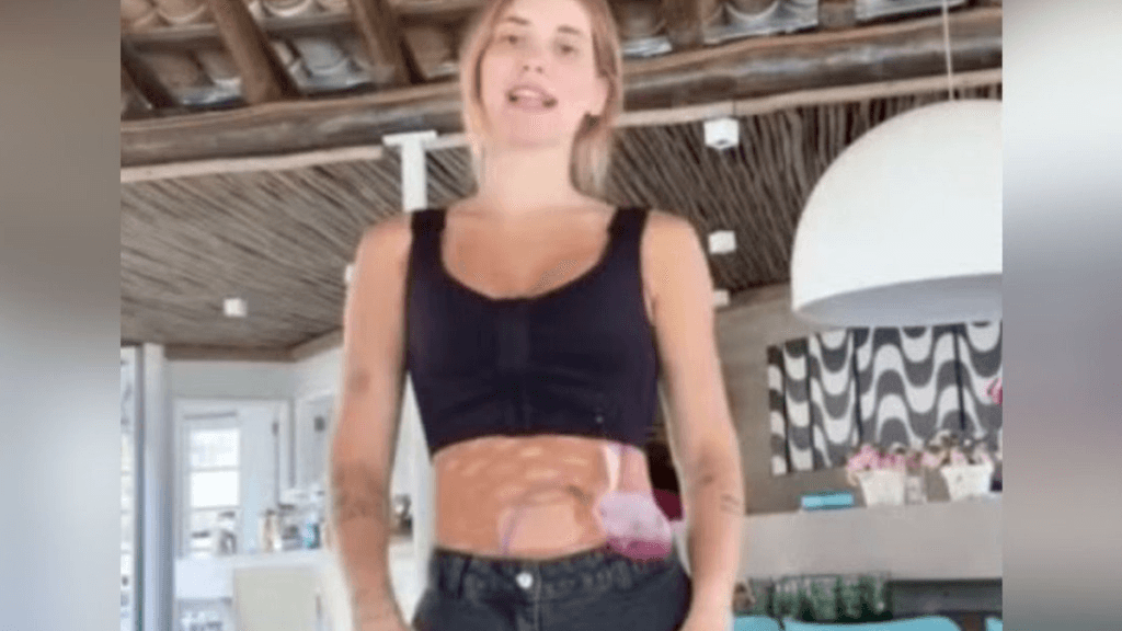 Virginia oferece R$ 50 mil para amigo beber sangue de dreno