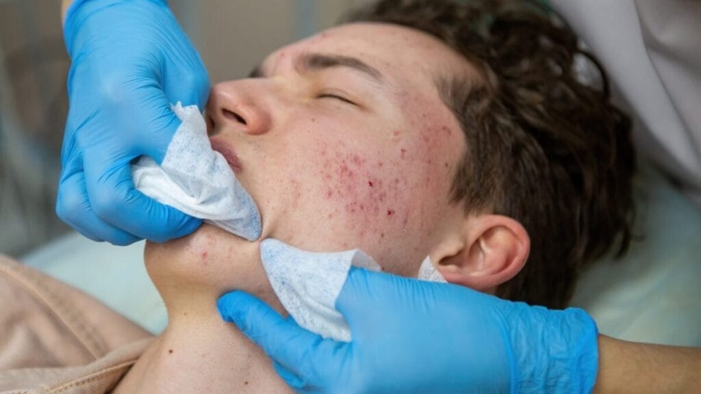 Gosta de assistir vídeos de cravos e espinhas? Ciência explica