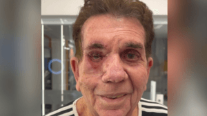 Reinaldo após tatuagem no globo ocular (Foto: Reprodução)