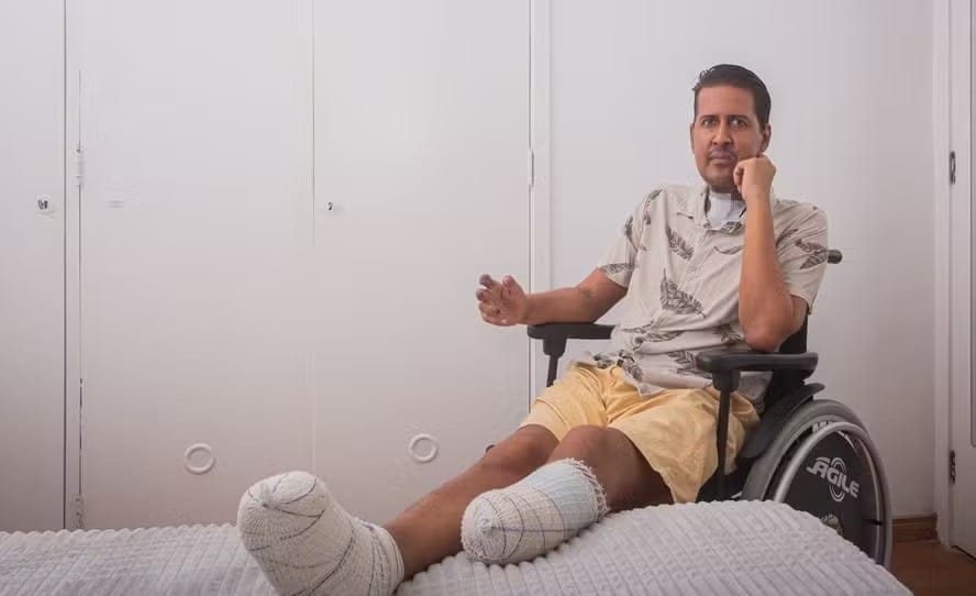 Jornalista fica em coma e tem membros amputados após cirurgia de apneia do sono