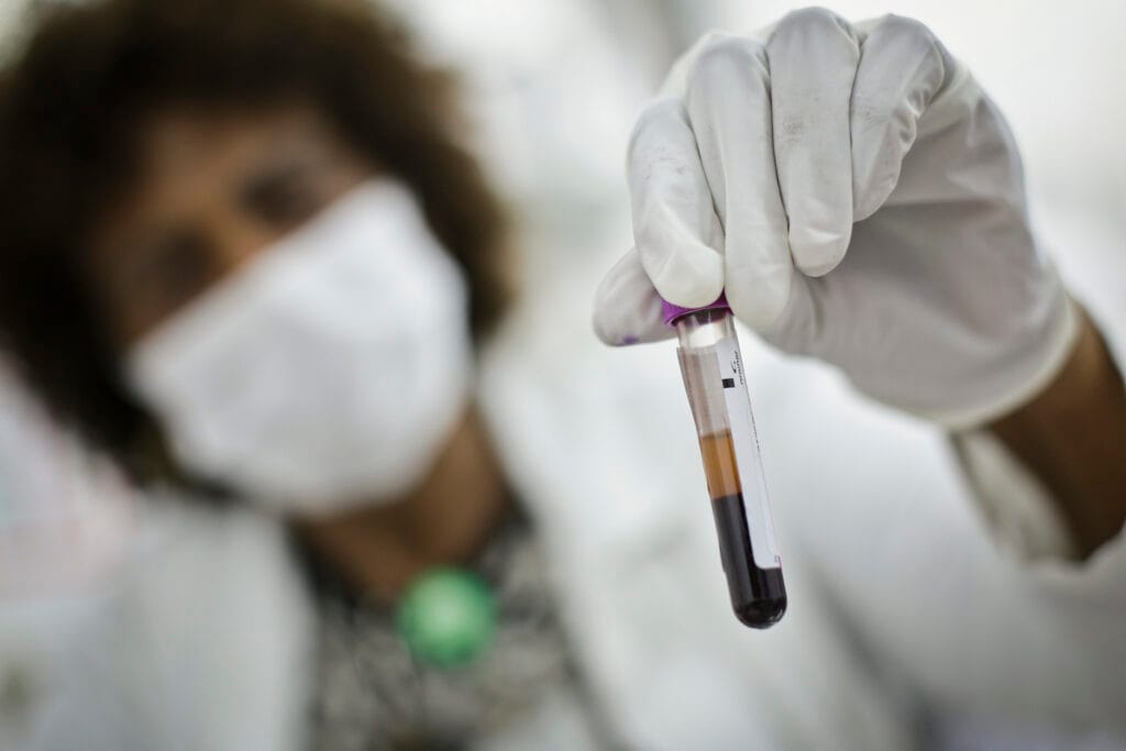 Rede pública de saúde do DF oferece amplo diagnóstico e tratamento para leucemias