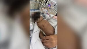 A imagem mostra a neném internada com baixa saturação