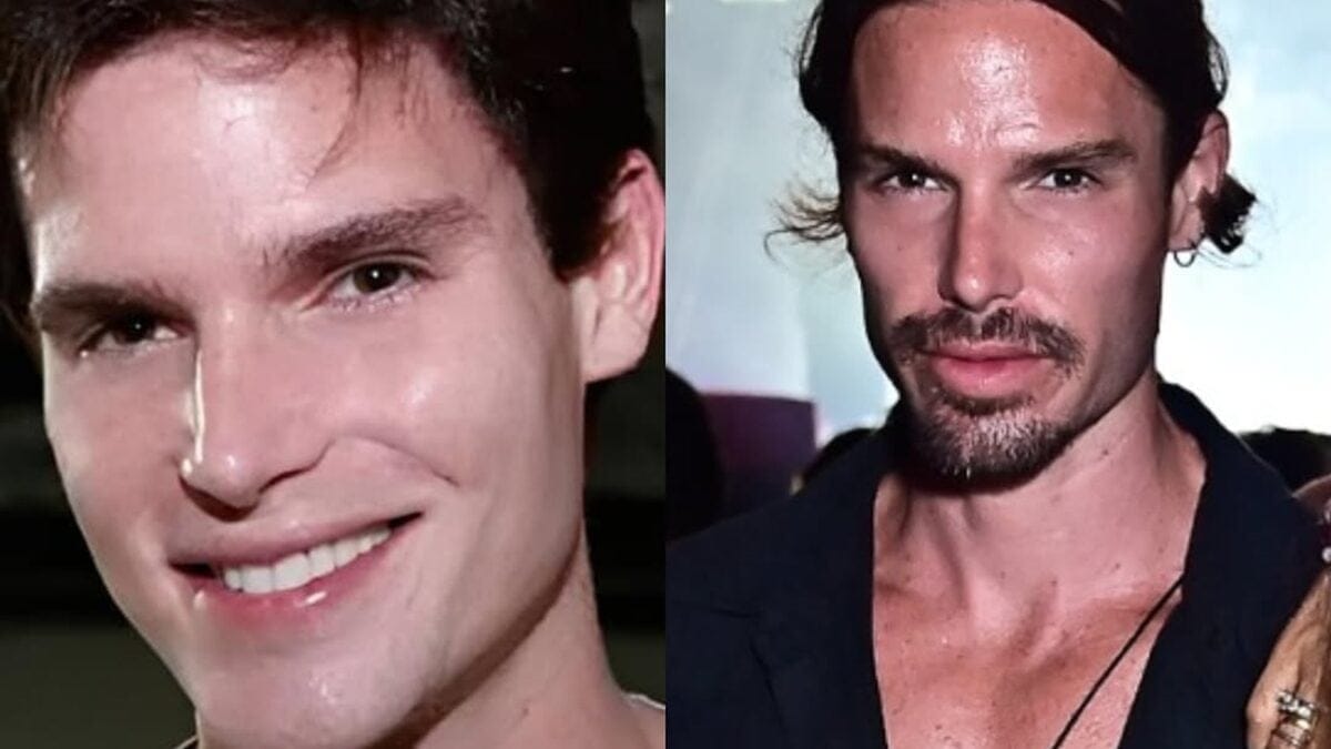 Jonatas Faro rebate críticas sobre sua harmonização facial beleza Ator iniciou a carreira em