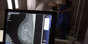 Câncer de mama: uma em cada três pacientes tem menos de 50 anos