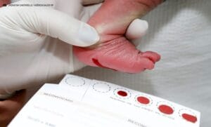 Doença Falciforme: diagnóstico precoce possibilita mais saúde e esperança às famílias