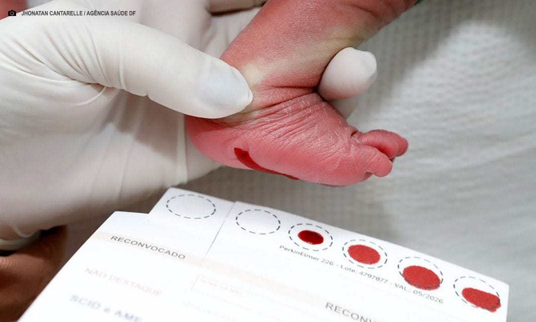 Doença Falciforme: diagnóstico precoce possibilita mais saúde e esperança às famílias