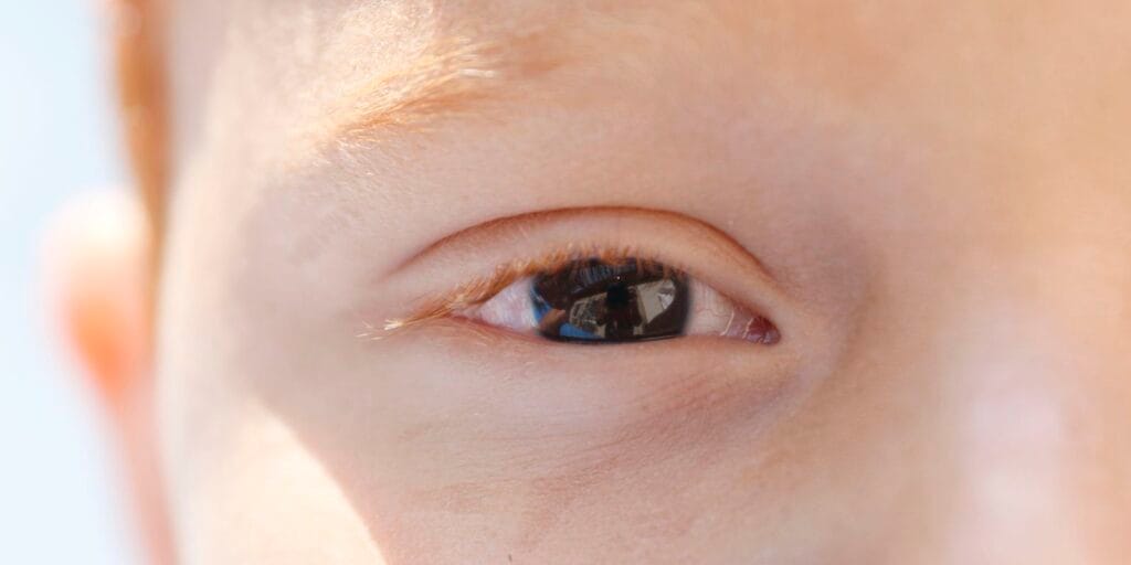 Erros de refração são principal causa de deficiência visual infantil