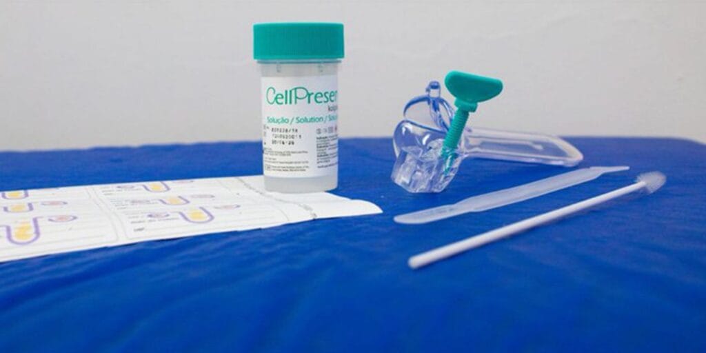 Saiba como é o novo teste do SUS para detectar câncer de colo do útero