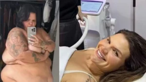 Thaís Carla revela busca por procedimentos estéticos após perder 100 kg