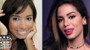 Anitta revela pressão por beleza na carreira: ‘Eu era feia’